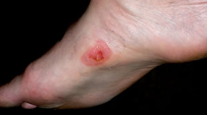 A Souvenir from Walt Stack 10K